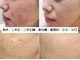 ナチュレアンドメディカ(Nature&Medica)の写真/エステ唯一のW美顔はトラブルを改善して美肌を生成！肌荒れ,赤ら顔,毛穴,シワ,シミ,ニキビを最新美容で改善