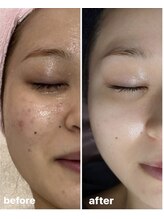 シャンティ(Shanti)/浜松市中区結果だし痩身専門店