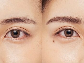 ヘップ(nail eyelashdesign Hep)の写真/口コミ高評価の実力派サロン！まつげパーマ&ハリウッドブロウリフトセット、2回コースなどクーポン多数♪