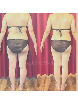 カラダ専家 恵びす(KARADA専家)/短期間で激変1