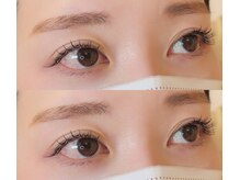 ネオリーブサイン(Neolive sign)/フラットラッシュ 100本