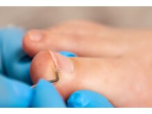 チップトップ(TIP TOP)