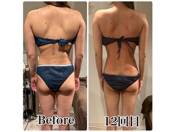 エステビジン 富山店(エステBIZIN)