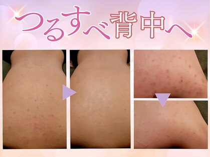 プライベートエステサロン トゥインクルの写真