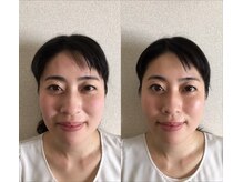 はいさい整骨院(haisai)/