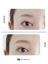 ブローム(Browm)/HBLとは