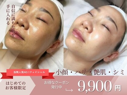 ラウナ(LAUNA)の写真