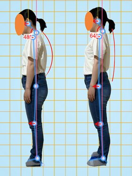 みふく整体院の写真/体の歪みが原因で不調が？AI姿勢・歩行分析で猫背・そり腰・腰痛・肩こりのケア！ベテラン施術◎