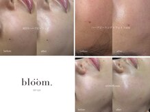 ブルーム(bloom.)