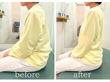 カイロライン 神楽坂通り整体院/頭痛×猫背矯正/beforeafter