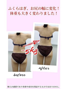 すばる整体院 小牧/before after/産後骨盤矯正/小牧