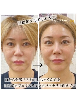 マージ イマージュ/フルアイエステの効果☆