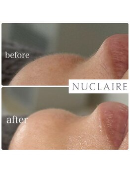 ここはな/お口の下もけっこうな産毛が。