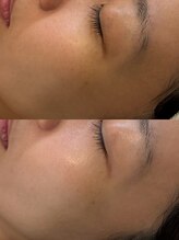 リノセス(Linocess)/美白/トーンアップ/キメ改善