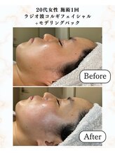 シーフェイス 横浜店(SEE FACE)/1度でハリツヤアップ！輝く肌へ