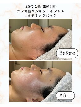 シーフェイス 横浜店(SEE FACE)/1度でハリツヤアップ!輝く肌へ