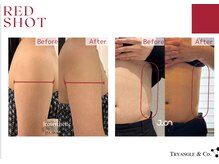 アンシャンテ(Anchant)/【レッドショット】