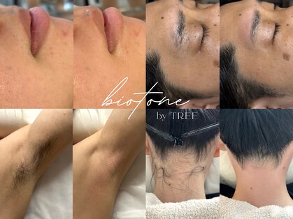 ビオトーン バイ ツリー(biotone by TREE)の写真