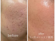アークヘアーダイ ネイル アンド アイラッシュ(ARK HAIR DAI)の雰囲気（話題の成分リジュランスキンケア♪ホームケアアイテムも取扱◎）