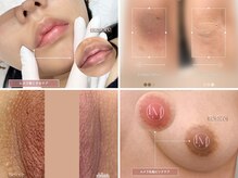 エルビービュティーサロン(LB BEAUTY SALON)の雰囲気(関西症例数No. 1を誇るメラニンケア☆ルメラ/黒ずみケア)
