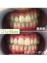 ルブラン 奈良店(Le Blanc)/自然で清潔感のある歯に！