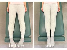 カイロライン 神楽坂通り整体院/産後骨盤矯正×腰痛/beforeafter