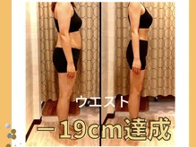 サロン セドナ(SALON SEDONA)/全身リンパ痩身 24回コース