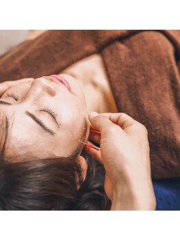 ヒューマン鍼灸接骨院/美容鍼が効く！