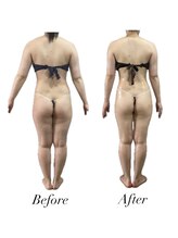 リノア(Lino'aka)/30代　○○さんの変化　痩ボディ