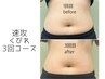 4月限定！短期集中【速攻くびれ】痩身コース3回　￥16500→￥13200