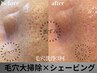 【毛穴大掃除】黒ずみ/詰まり 毛穴洗浄×シェービング 120分 ¥16500→¥11000