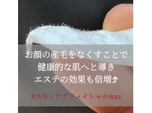 メディカルサロン ファン(FUN)の雰囲気(シミケア/ニキビケア/毛穴ケア/京都肌改善/肌管理)