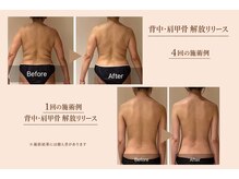 シェアサロンエムズ(share salon M's)の雰囲気(背中・肩甲骨解放リリース|施術例をご紹介)
