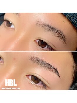 ヴィータ(VITA)/ハリウッドブロウリフト