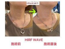 ジナ ビューティ(GINA BEAUTY)/首のエイジングケア♪