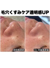 リシェ 市川(riche)/