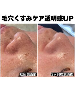 リシェ 市川(riche)/