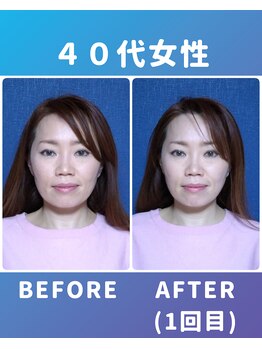 ぐっすりん/初回体験のお客様の変化(1)