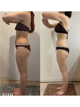 ヴィクシア(VIXIA)/痩身90分