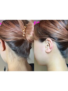 1回ごとにお支払い可能なサロン