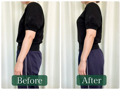 まっさ鍼灸整骨院 京王堀之内院の写真