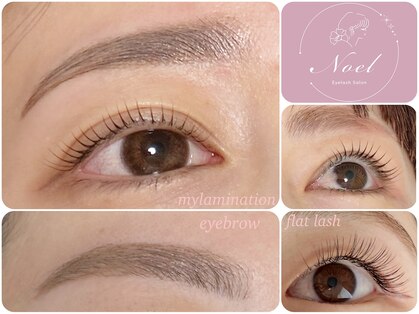 ノエル 下北沢(Noel)の写真