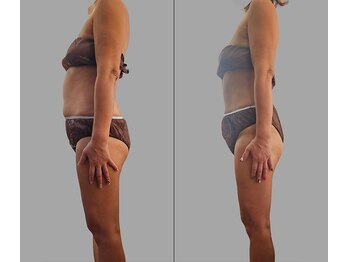 プラスイー(+e)/50代からでもしっかり変化!