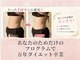 ヨサパーク アイミー(YOSA PARK Ime)の写真