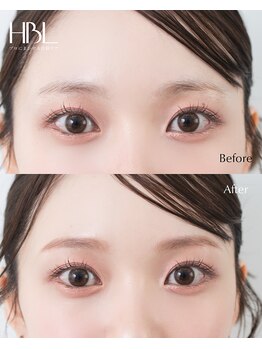 カルス(carus)/HBL before/after
