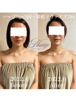 ニュアージュ(Nuage)/約2ヶ月の結果