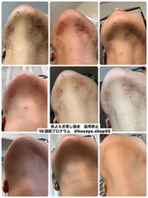 イチハチドット(18.)/全身美容の若草☆