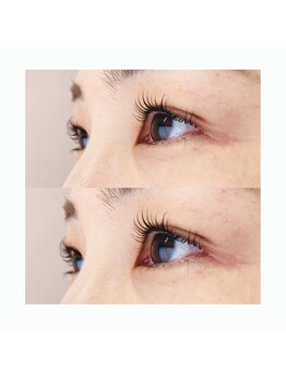 ファーストアイ(First eye)/マイラミネーション