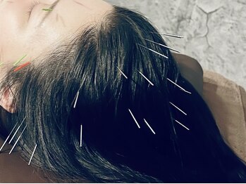 ヘッドサイエンス(HEADSCIENCE)/美容鍼灸×あん摩マッサージ指圧