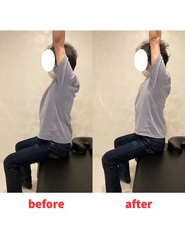 ナオル整体 福岡香椎院(NAORU整体)/50代男性施術事例【肩こり】